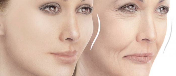 نتائج علاج تجاعيد الوجه بالكولاجين
